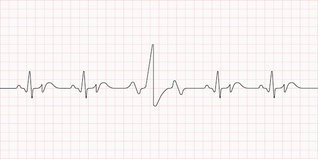 Elettrocardiogramma. Battito cardiaco. Simbolo sanitario medico