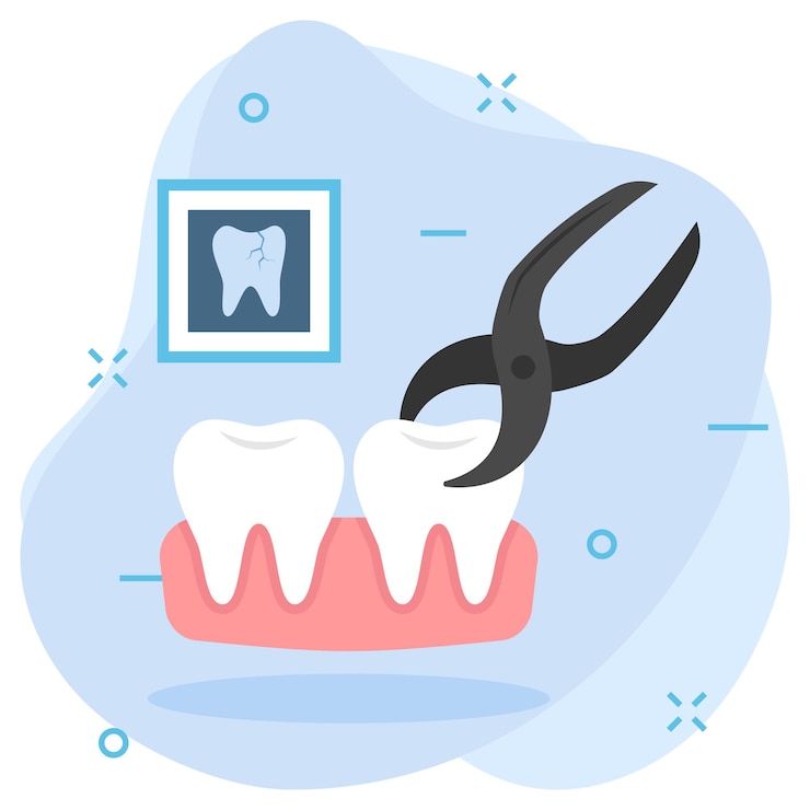 Estrazione dei denti in una clinica dentistica concetto di estrazione o rimozione di denti difetti utilizzando pinze dentistiche