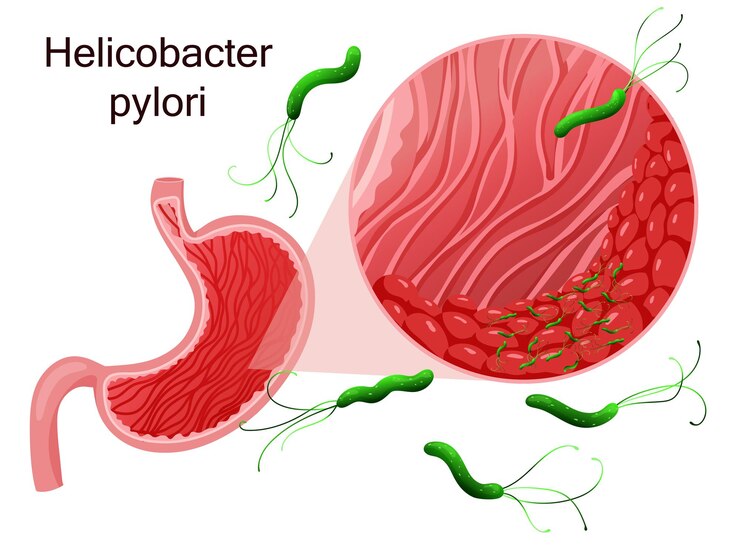 Vettore helicobacter pylori nelle cellule epiteliali dello stomaco sotto ingrandimento illustrazione vettoriale in stile cartone animato
