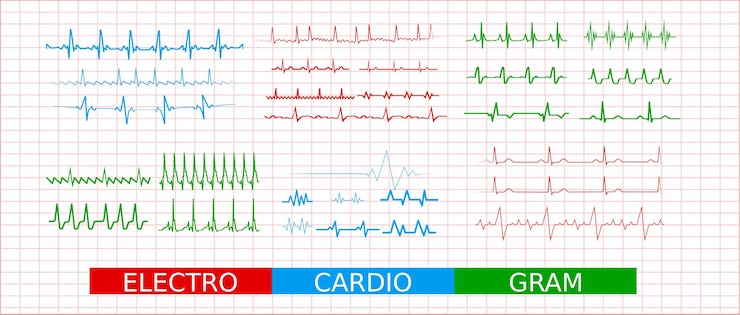 Vettore icone della frequenza cardiaca dell'ecg