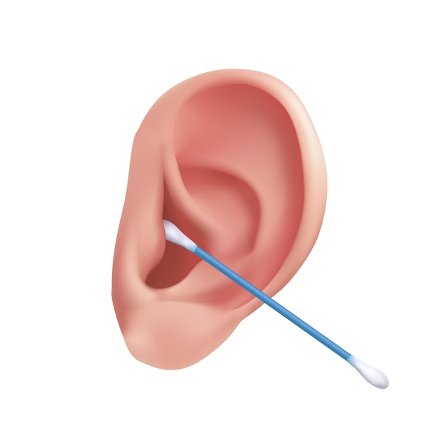 Igiene del condotto uditivo con un batuffolo di cotone. pulire l'orecchio umano dal cerume da vicino
