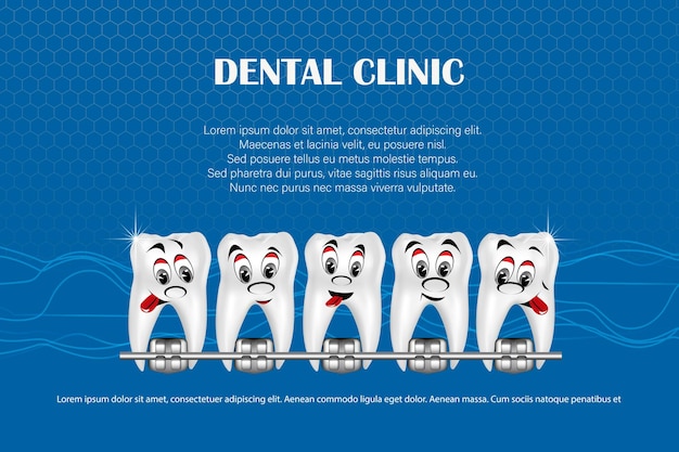 illustrazione vettoriale 3d denti realistici con parentesi graffe mascella superiore e inferiore Allineamento del morso della dentatura dei denti con parentesi graffe apparecchi dentali