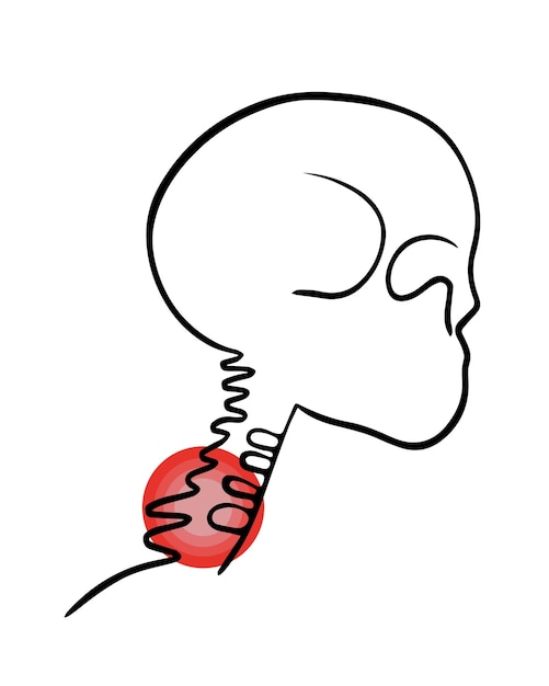 Illustrazione vettoriale isolata del dolore delle vertebre cervicali Disegno del contorno della regione cervicale con localizzazione del dolore nelle vertebre