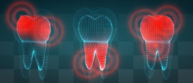 Insieme di vettore dei denti 3d su uno sfondo scuro mal di denti