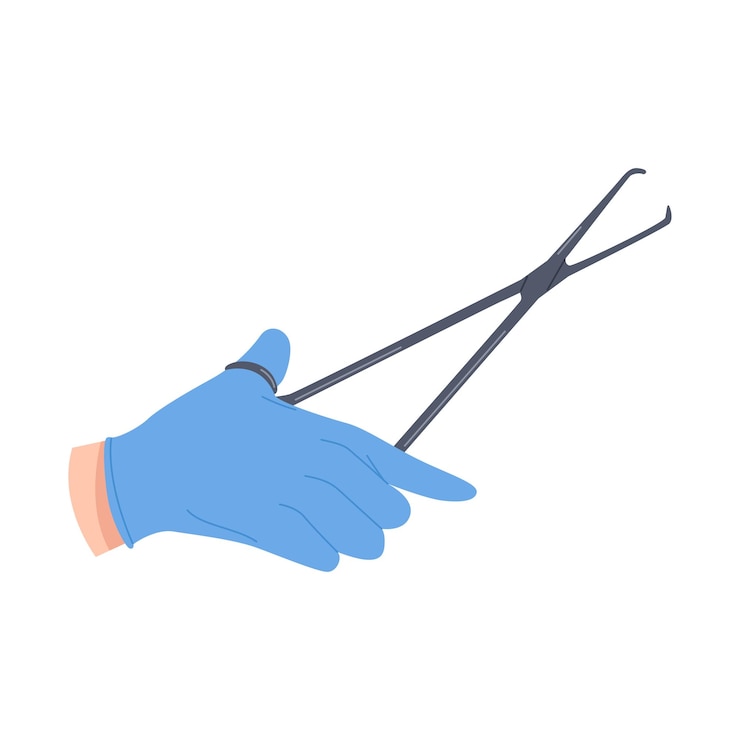 Vettore la mano del chirurgo con un guanto di lattice che tiene una pinzetta di metallo chirurgico durante l'operazione