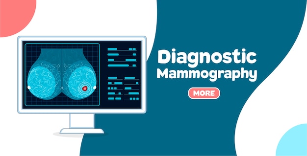 Mammografia diagnostica. Procedura di esame mammografico nella clinica moderna. Prevenzione del cancro al seno