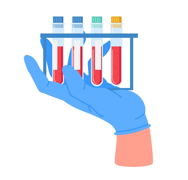 Mani di operaio di laboratorio che tengono campioni di sangue Mani di dottore con guanti di gomma con tubi di analisi del sangue Tubi medici di prova del sangue Illustrazione vettoriale piatta Tubi di prova del sanguigno in mano dell'assistente di laboratorio
