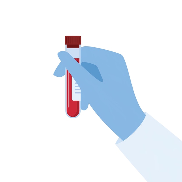 Mano di Doctor039s in un guanto medico che tiene la provetta con il sangue Ricerca di laboratorio