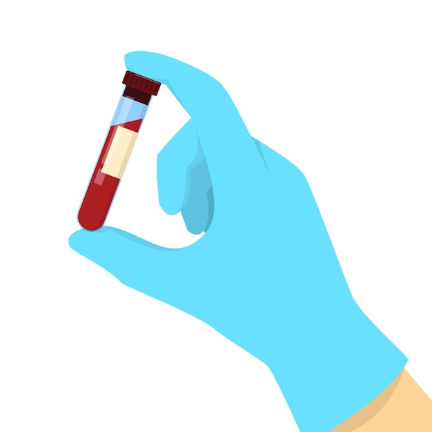 Mano in guanto medico che tiene un campione di sangue in una provetta di vetro