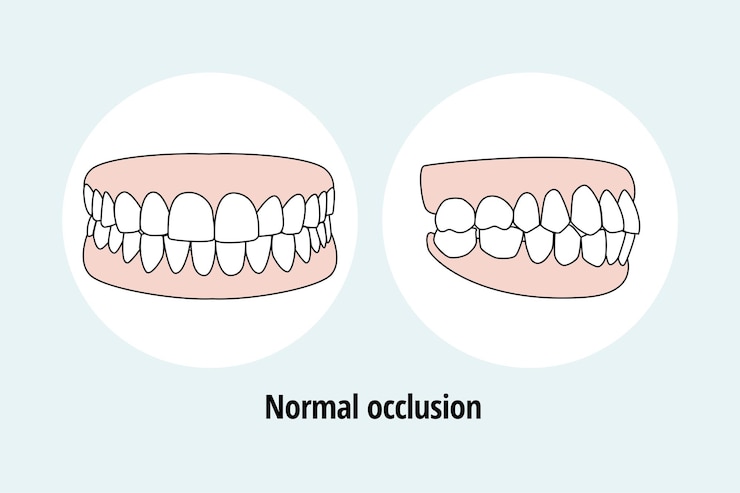 Vettore occlusione normale illustrazione vettoriale del problema dentale concetto di cura dentale