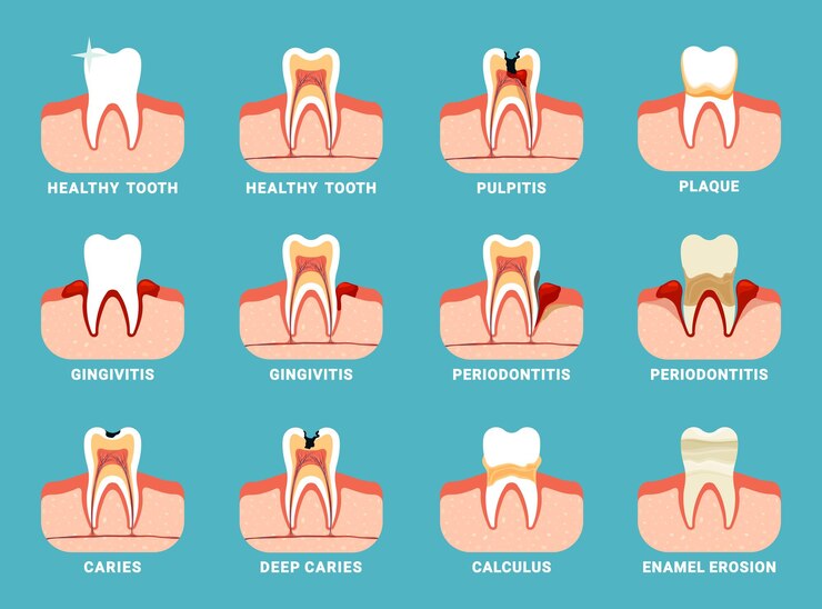 Problemi dentali denti diversi danneggiati alito cattivo orale informazioni per la cura dei denti Modelli piatti vettoriali