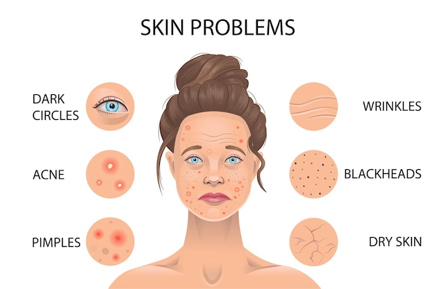 Problemi di pelle. Illustrazione vettoriale.