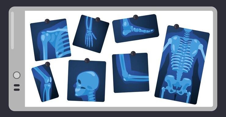 Vettore raggi x sullo schermo del medico parti dello scheletro umano sul cuscinetto luminoso chirurgico parti del corpo concetto di raggi x medici illustrazione vettoriale immagini di scansione del ginocchio e del torace della gamba del cranio e del torace