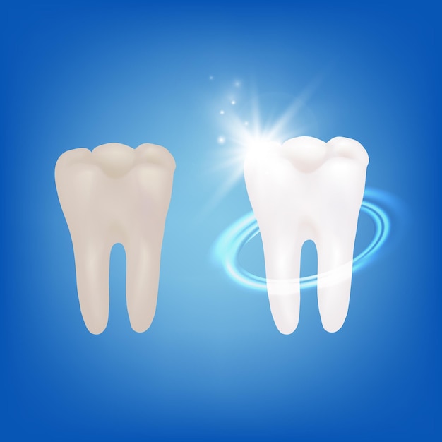 Realistico dettagliato 3D sbiancamento dei denti concetto vettore