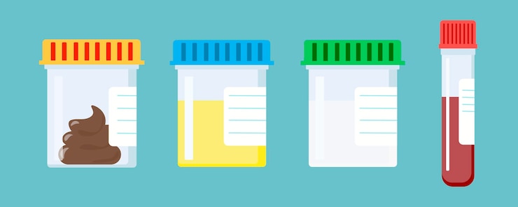 Vettore set di provette vettoriali con tappi feci sangue urina sperma illustrazione del trattamento in farmacia