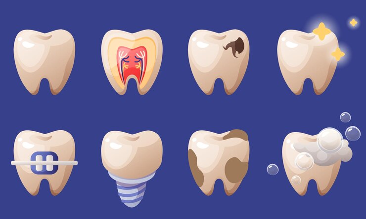 Set vettoriale di denti Problemi dentali Carie placca tartarica Implanti apparecchi ortodontici