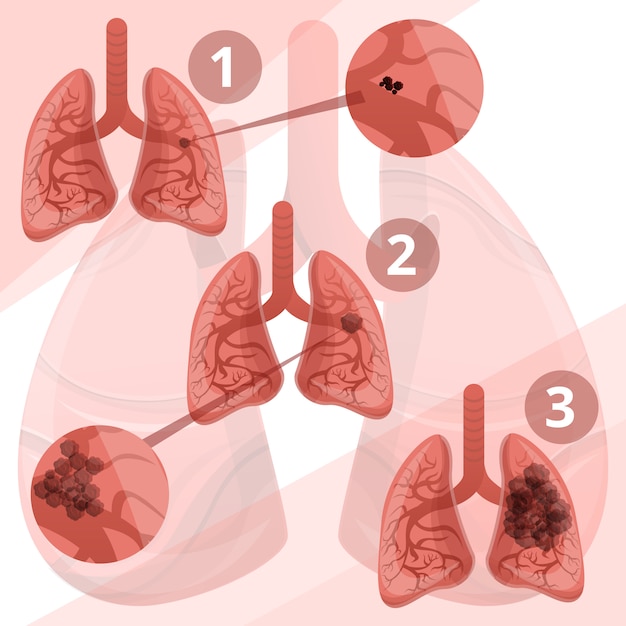 Sistema polmonare infografica, stile cartone animato