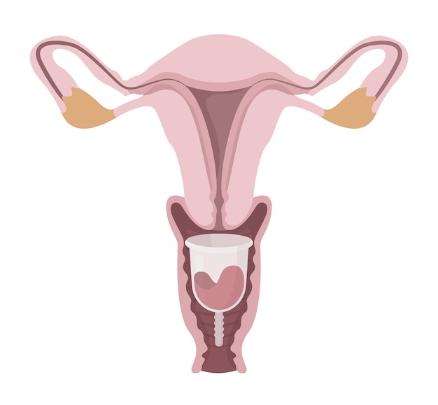 Sistema riproduttivo femminile con una coppetta mestruale all'interno