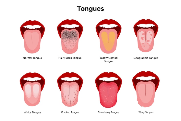 Vettore tinguette nere pelose e bianche ricoperte di giallo geografico normale a fragola rotta
