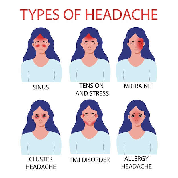 Tipi di mal di testa. ALLERGIA, ATM, dolore alle articolazioni temporomandibolari, cefalea a grappolo, MIGRAINA, seno, tensione e stress Illustrazione vettoriale.