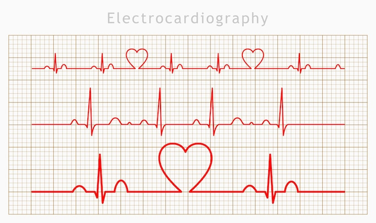 Vettore vettore insieme di grafici del cardiogramma del cuore