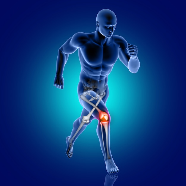 3D mannelijk medisch cijfer dat met benadrukt kniebeen loopt