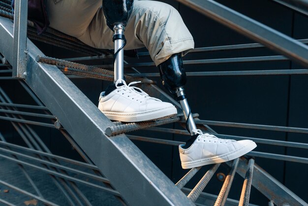 Aanzicht van een man met prothetische benen en witte sneakers zittend op een metalen trap