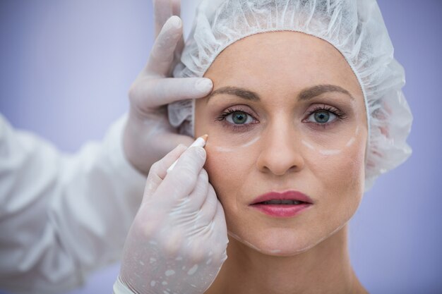 Arts die het gezicht van vrouwelijke patiënten voor kosmetische behandeling merken