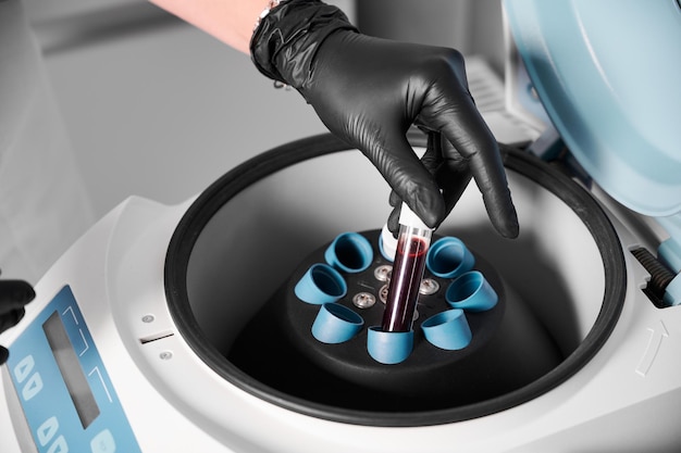 Bereiding van bloed voor injecties schoonheidsspecialist zet buisje bloed in centrifuge