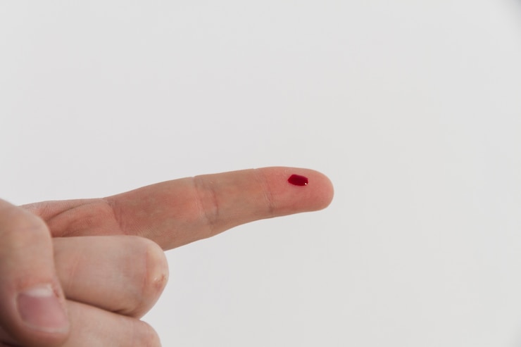 Gratis Foto bloeden vinger