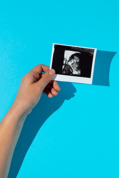 Bovenaanzicht hand met echografie