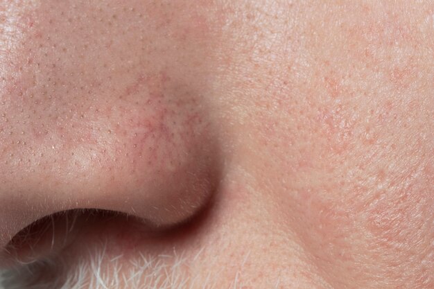 Close-up op de textuur van de gezichtsporiën