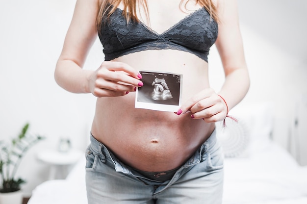 Close-up van een zwangere vrouw met echografie foto voor haar buik