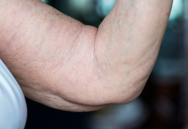 Close-up van losse bejaarde arm