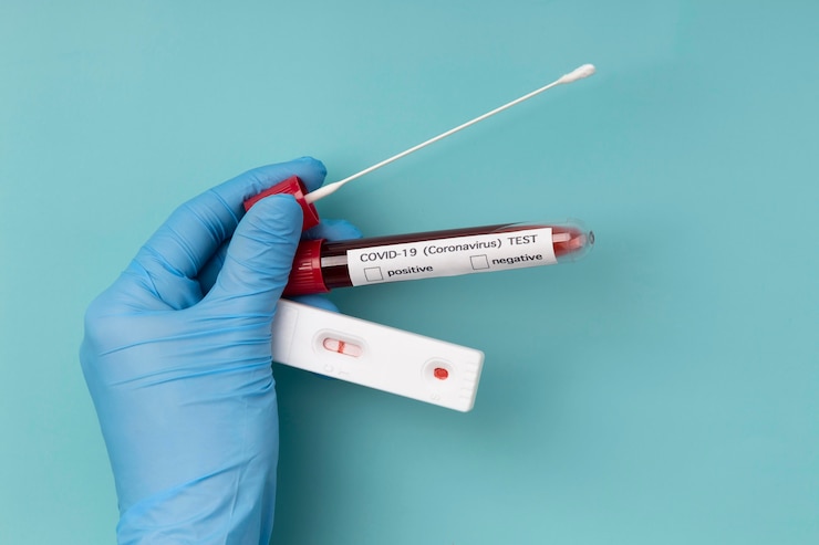 Gratis Foto coronavirus testassortiment in lab