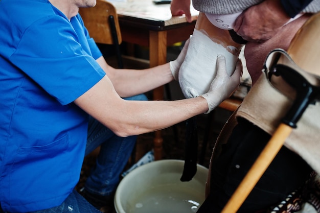 De prothesemaker verwijdert de maatregel van een persoon met een handicap vrouw met geamputeerde