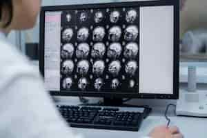 Gratis foto dokter kijkt over ct-scan