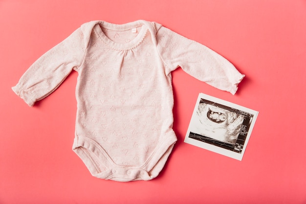 Echografie foto met baby onesie op perzik achtergrond