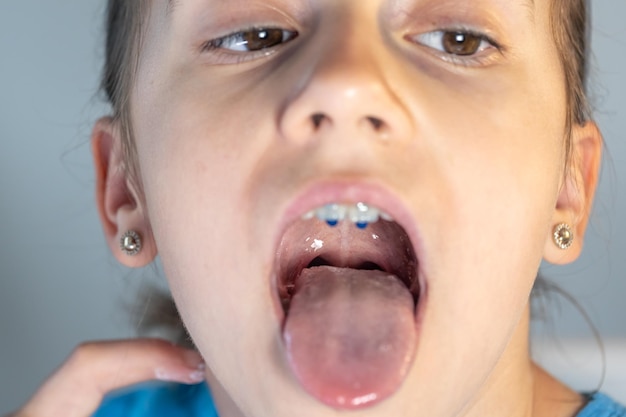 Gratis foto een kindmeisje opent haar mond en laat haar tong zien