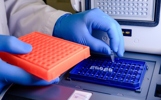 Een laboratoriummedewerker die pipetpunten in een blauwe container schikt voor een coronavirus testen