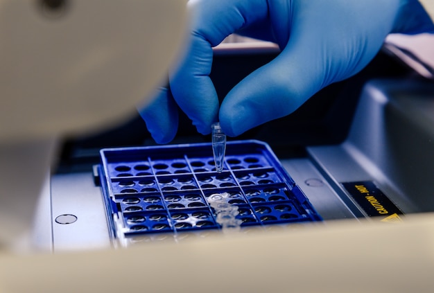 Een laboratoriummedewerker die pipetpunten in een blauwe container schikt voor een coronavirus testen