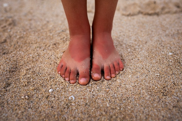 Gratis foto gezicht op de door de zon verbrande voeten van een kind door het dragen van sandalen op het strand