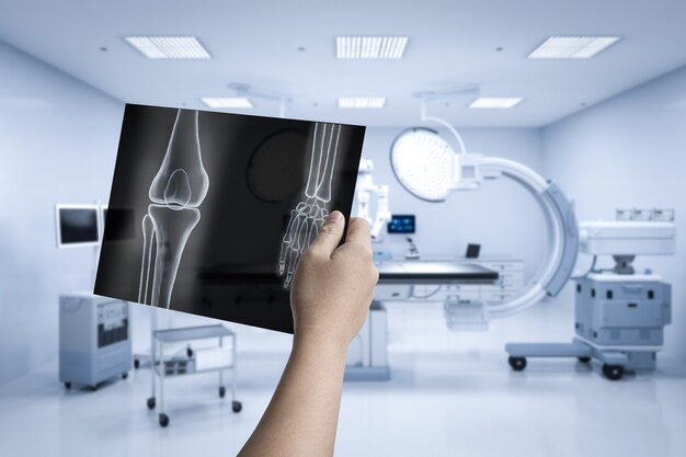 Hand met röntgenfilm met 3d-rendering mri-scanmachine of scanapparaat voor magnetische resonantiebeeldvorming
