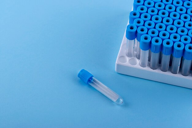 Hooghoekige flesjes met blauwe achtergrond