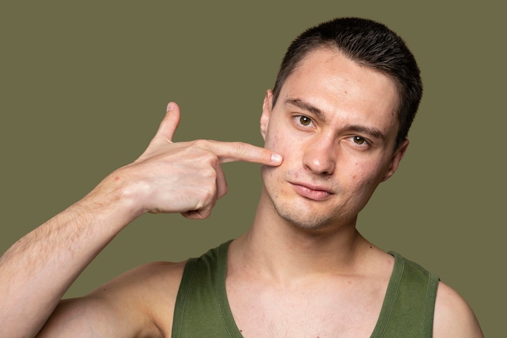Gratis Foto jonge knappe man die vertrouwen heeft in zijn acne