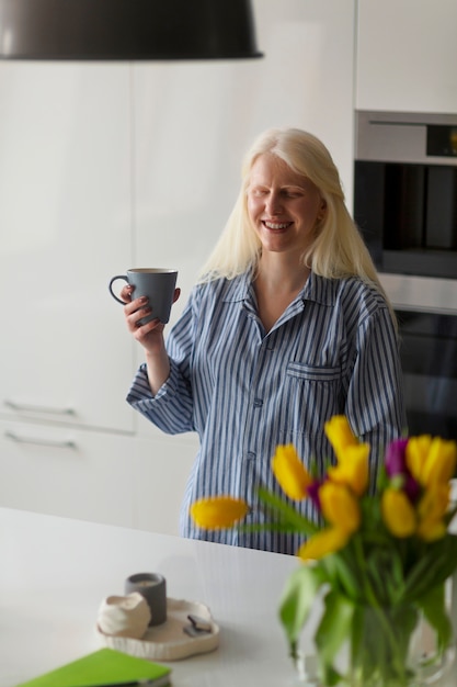 Gratis foto jonge vrouw met albinisme en tulpenbloemen