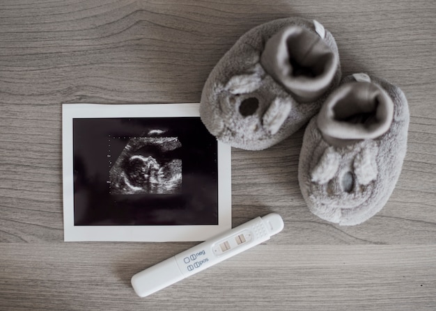 Gratis foto leuke kleine schoenen en x ray foto