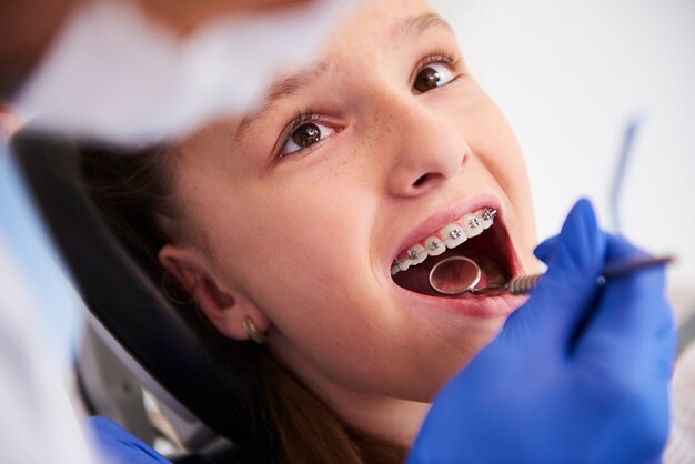 Meisje met beugel tijdens een routine, tandheelkundig onderzoek