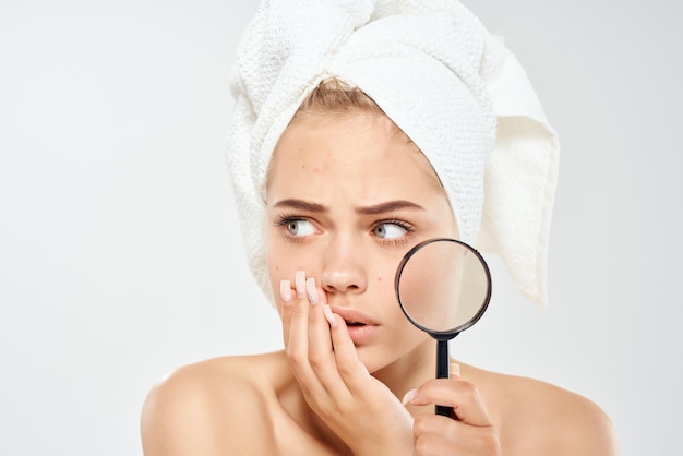 Mooie vrouw met een handdoek op mijn hoofd acne op de gezichtsdermatologie. hoge kwaliteit foto
