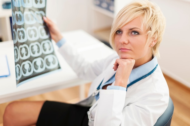 Nadenkend vrouwelijke arts met x-ray beeld